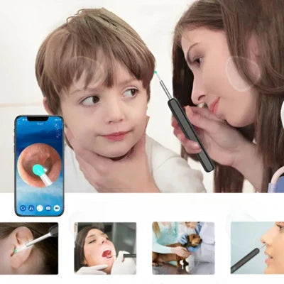 KIT DE LIMPIEZA PARA OÍDOS INTELIGENTE CON CÁMARA 👂🏻👁️📲